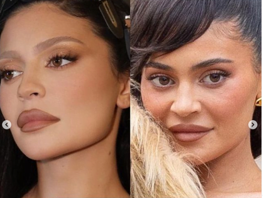 The Dark Side of Celebrity Beauty: Analyzing the Effects of Photoshop and Cosmetic Surgery on Body Image