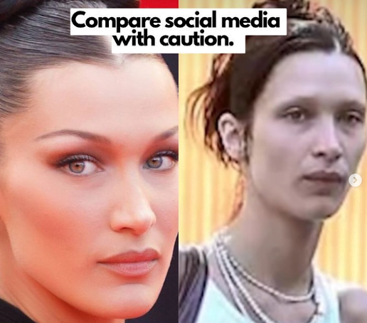 The Dark Side of Celebrity Beauty: Analyzing the Effects of Photoshop and Cosmetic Surgery on Body Image