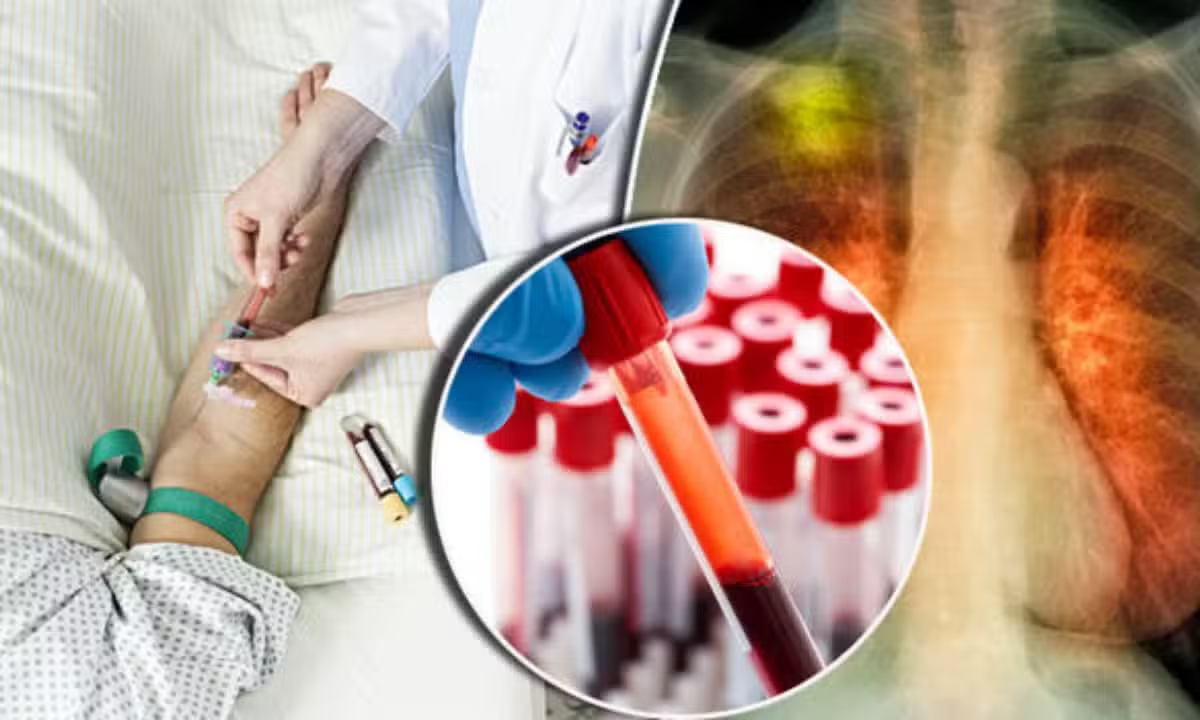 New Blood Test Could Predict Lung Cancer Risk Up to Five Years Before Diagnosis