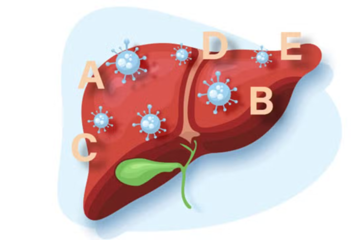 Pakistan Ranks Fifth Globally in Viral Hepatitis Burden, Says PMA