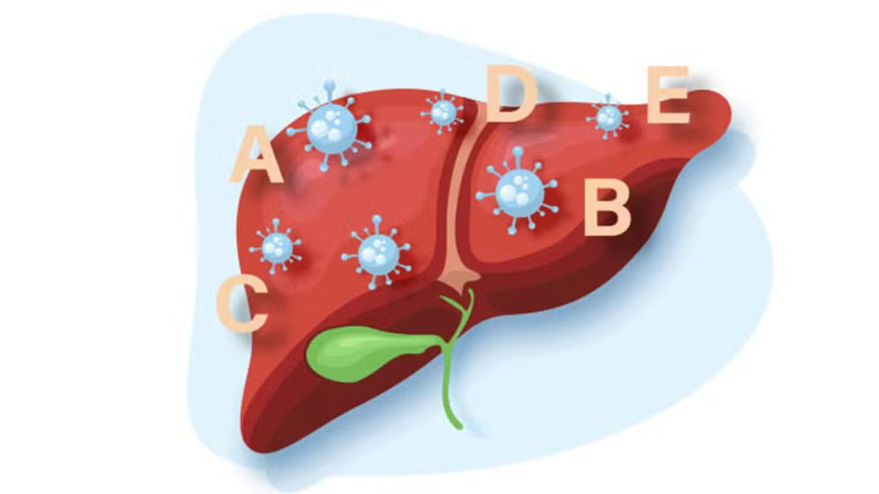 Pakistan Ranks Fifth Globally in Viral Hepatitis Burden, Says PMA