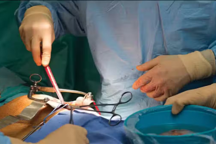 Nearly 30 Million Pakistanis Suffer From Kidney Disease, Nephrologists Warn