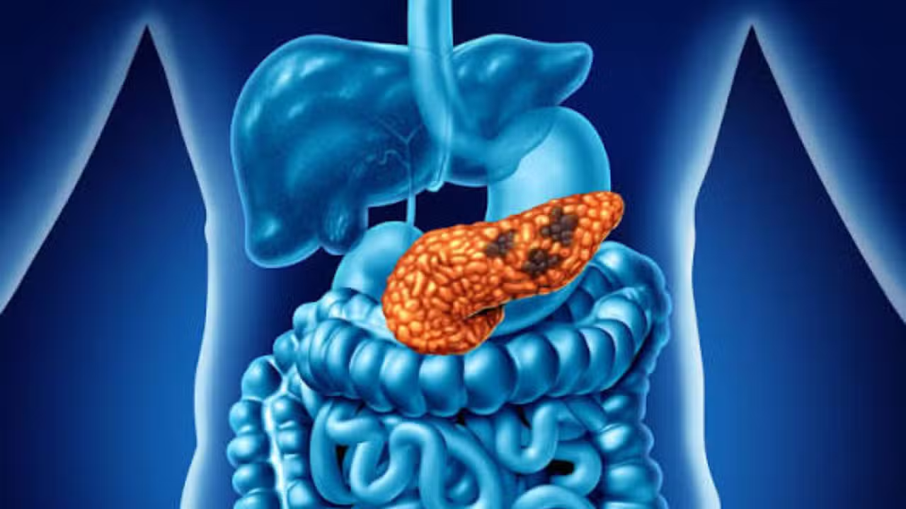 FDA Approves New Pancreatic Cancer Pill After Trial Shows Survival Benefits